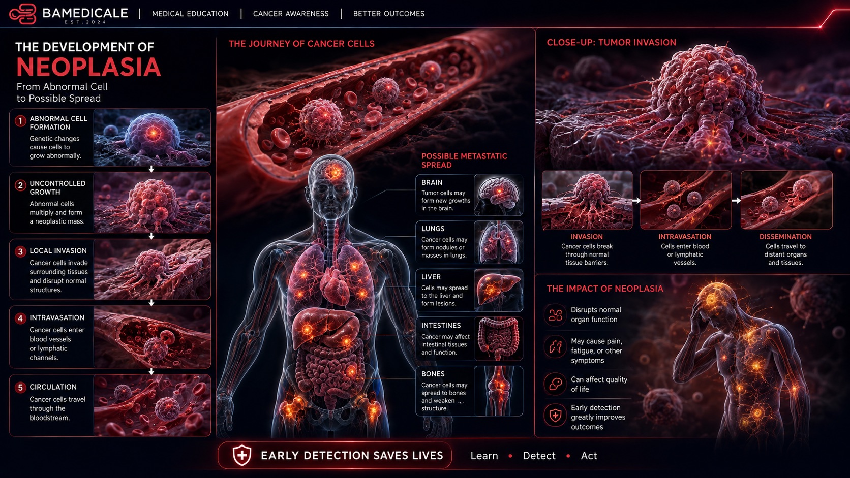 Development of neoplasia educational infographic