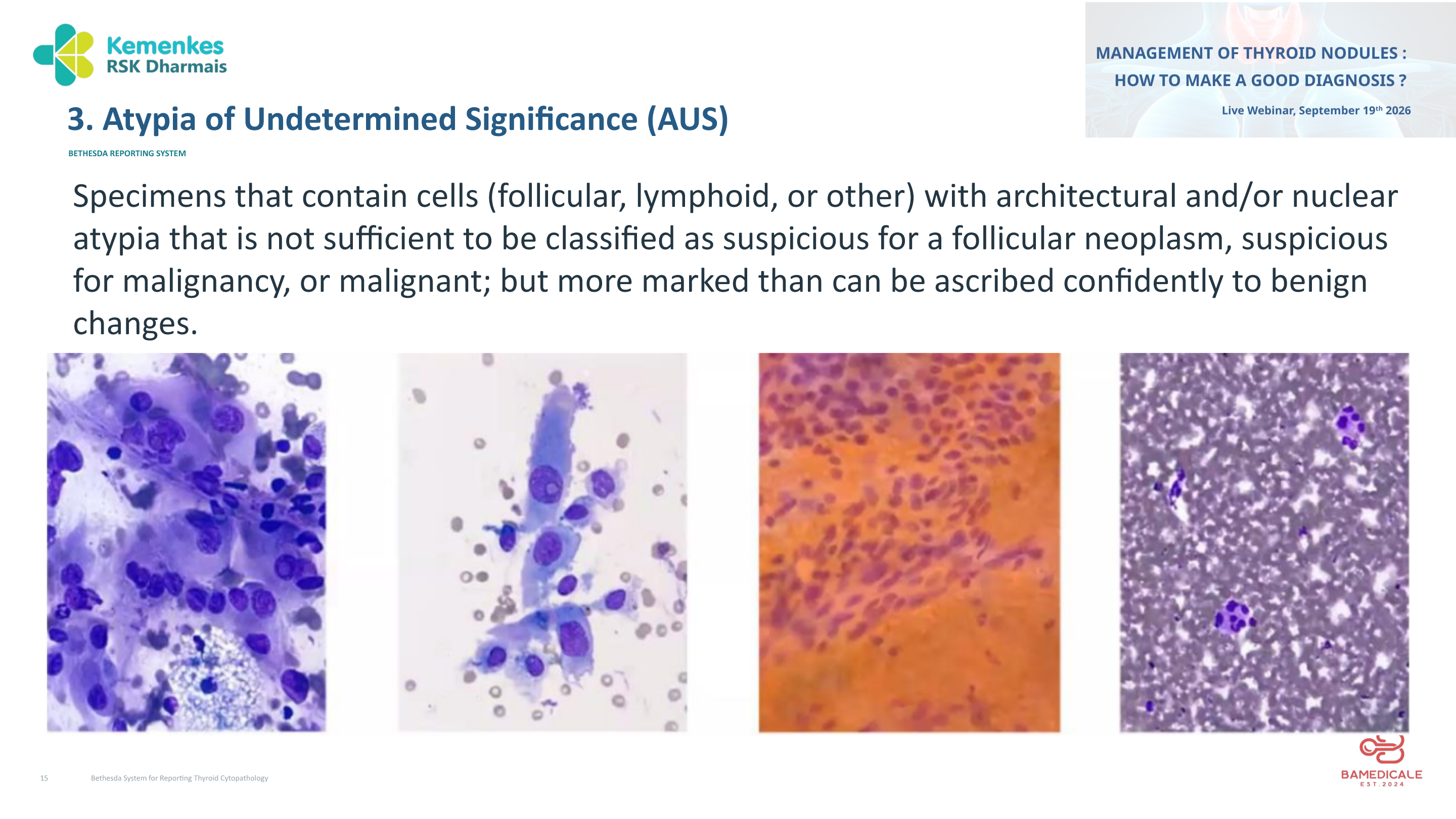 Original presentation slide 15; selectable text follows