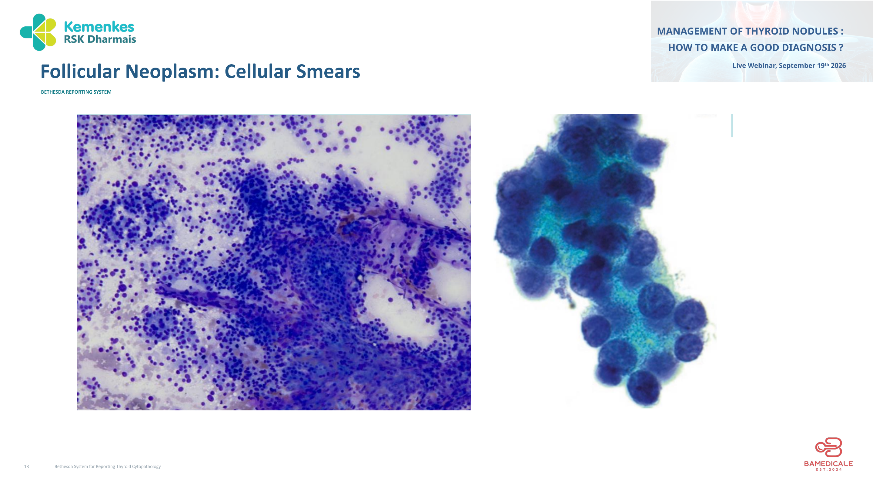 Original presentation slide 18; selectable text follows