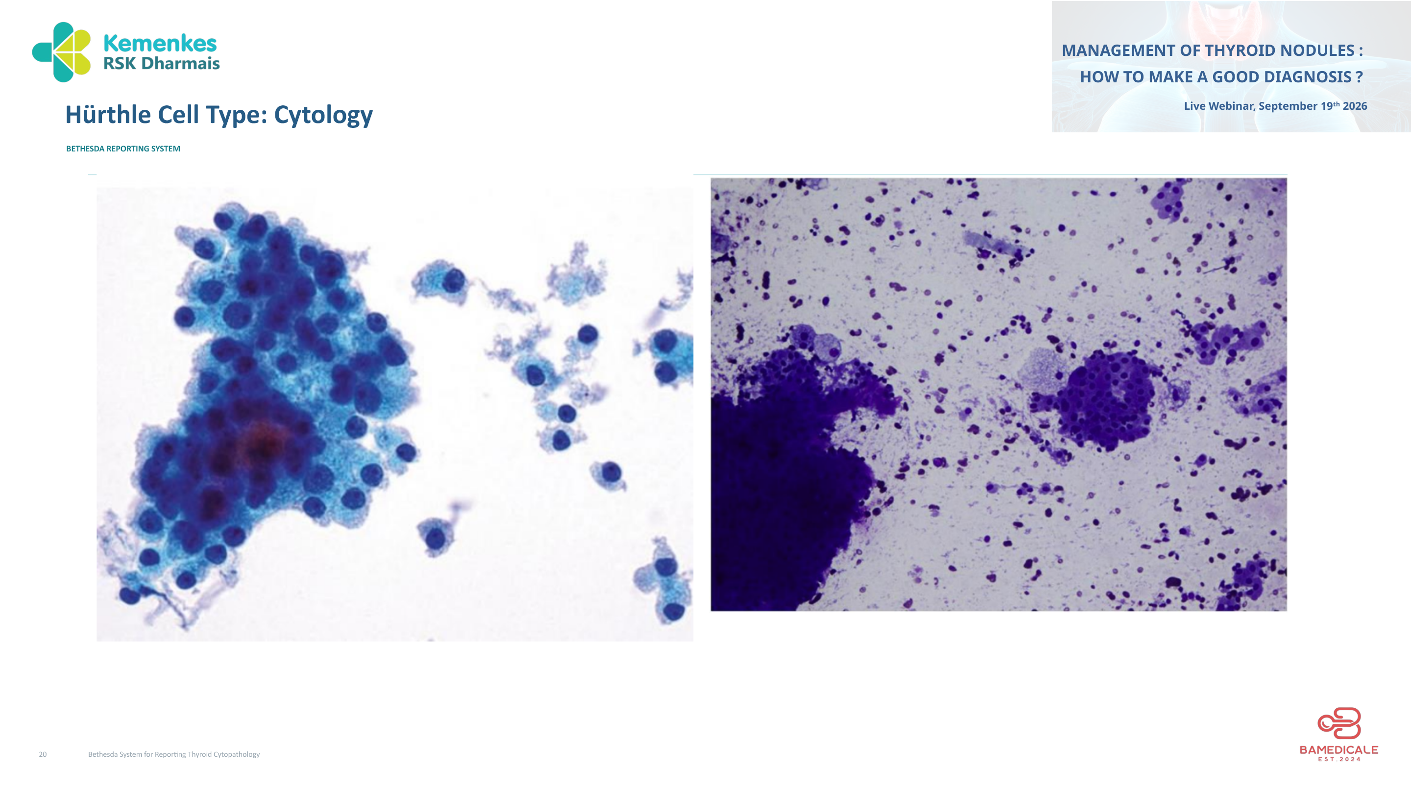 Original presentation slide 20; selectable text follows